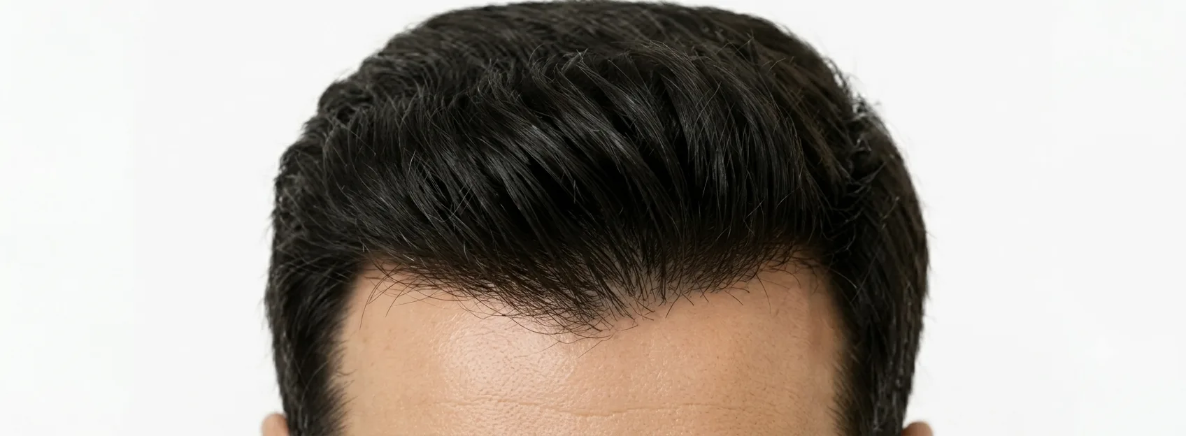 Regrowth & Density